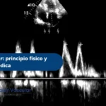 El efecto doppler- Ecodoppler Bogotá
