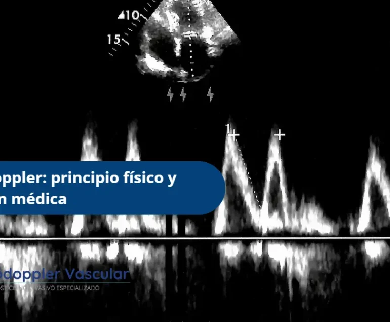 El efecto doppler- Ecodoppler Bogotá