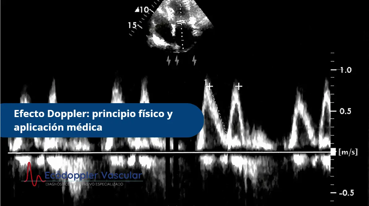 El efecto doppler- Ecodoppler Bogotá