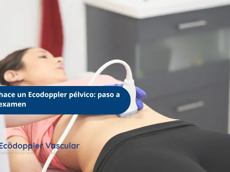 Cómo se hace una ecografía doppler pélvica - Ecodoppler Vascular - Bogotá, Colombia