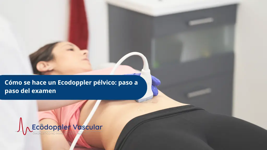 Cómo se hace una ecografía doppler pélvica - Ecodoppler Vascular - Bogotá, Colombia