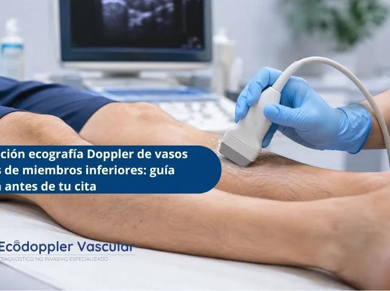 Preparación ecografía Doppler de vasos venosos de miembros inferiores guía práctica antes de tu cita -ECODOPPLER